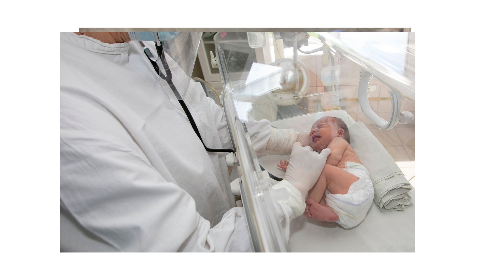 “DAMPAK PAPARAN CAHAYA TERHADAP KUALITAS TIDUR  BAYI PREMATURE DI RUANGAN NICU”